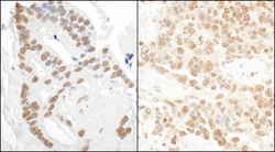 DDX27 Antibody, Novus Biologicals 0.1mg; Unlabeled:Antibodies, Polyclonal